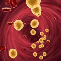 cholesterol