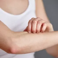psora