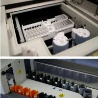 θεραπεία για αλτσχάιμερ