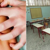 νορβηγική ψώρα