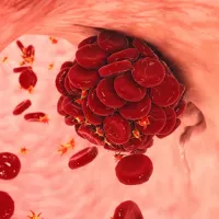 thrombos