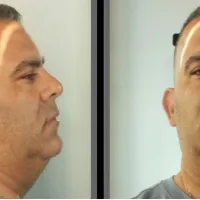 Σάμος