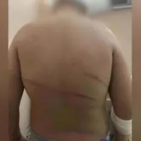 13χρονος ξυλοδαρμός