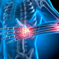 arthrwseis