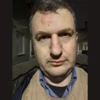 Άγριος ξυλοδαρμός του εκδότη της εφημερίδας «Μαγνησία» στον Βόλο – «Δεν μας πτοούν οι τραμπουκισμοί»