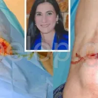 Ένα σοκαριστικό περιστατικό με θύμα μια μητέρα τριών παιδιών σημειώθηκε στην Πάτρα και συγκεκριμένα στα σύνορα ανάμεσα σε Νέο Σούλι και Ριγανόκαμπο.