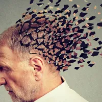 alzheimer