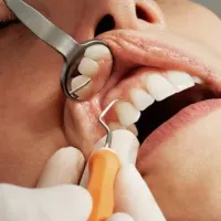 teeth