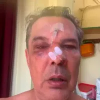Απρόκλητη επίθεση στο Χαϊδάρι