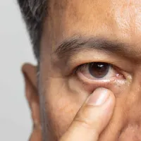 eyees