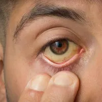 yellow eyes