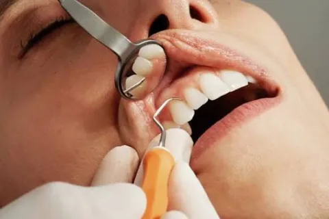 teeth