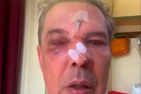 Απρόκλητη επίθεση στο Χαϊδάρι