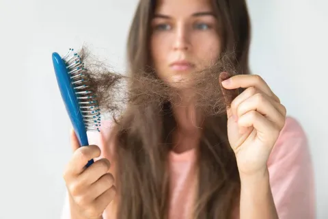 hairloss
